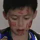 阿殇
